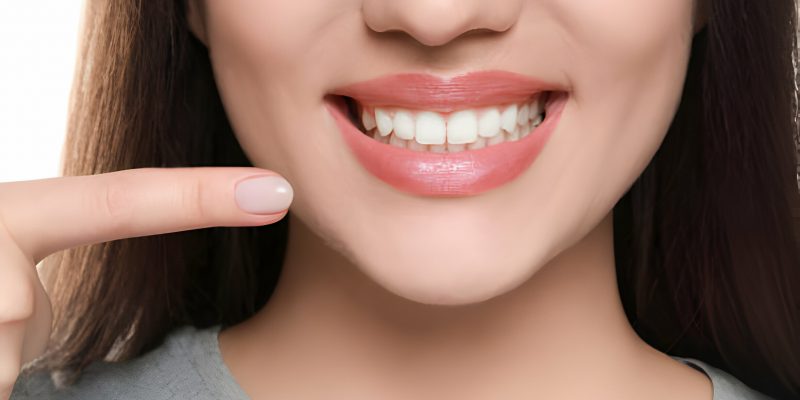 How to Maintain Your Bright Smile After Teeth Whitening_FI
