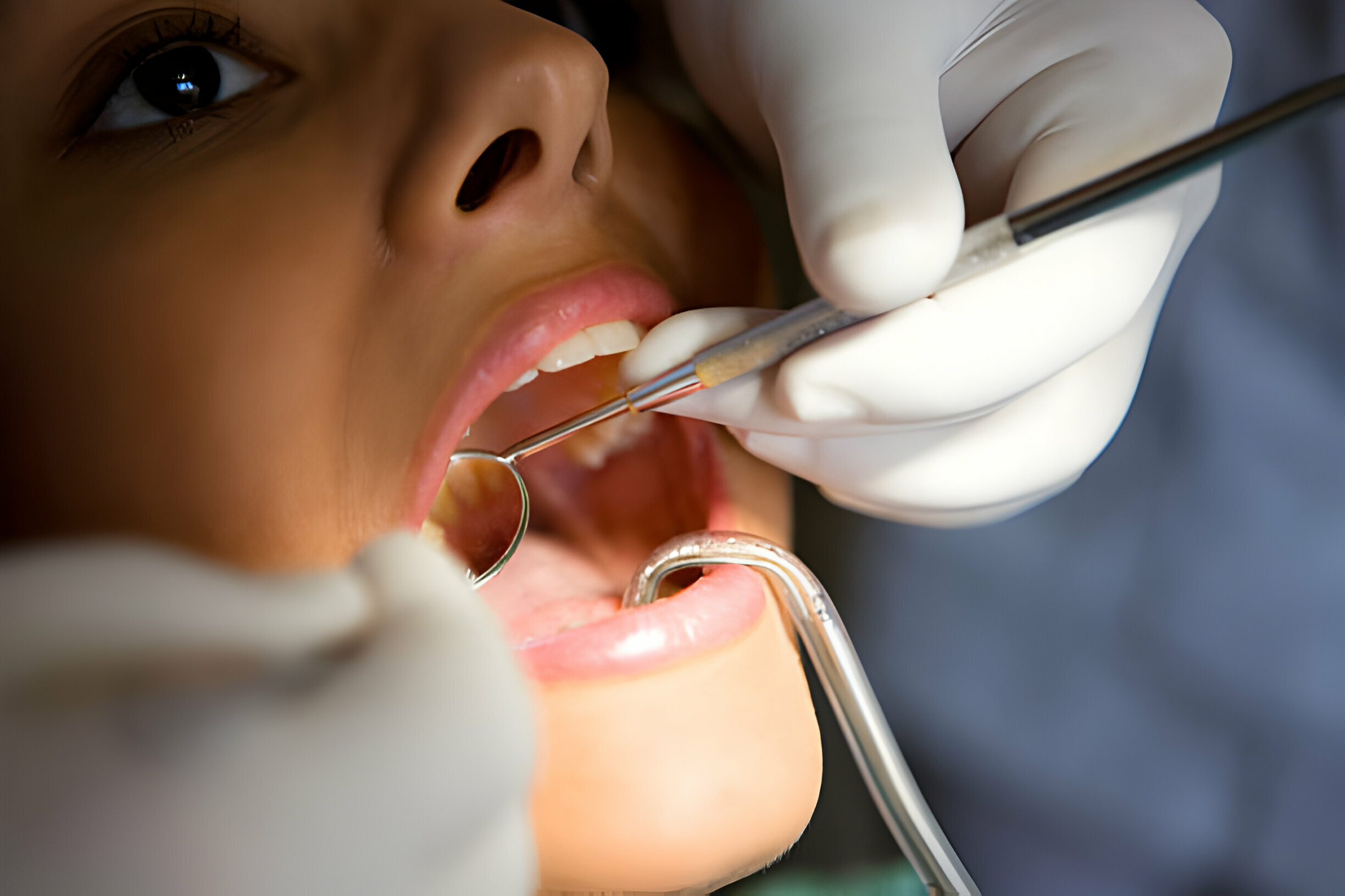 Exploring Different Types of Restorative Dental Procedures: Which One is Right for You?_3