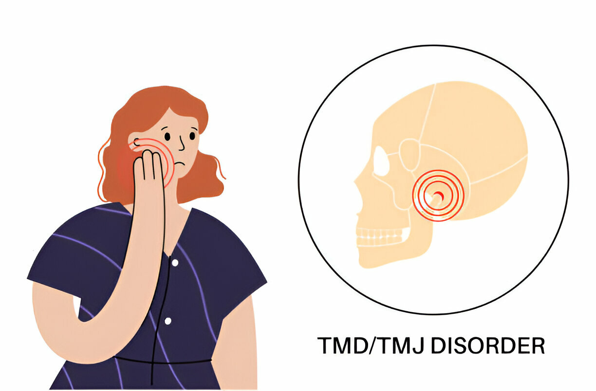 How to Choose the Best TMD/TMJ Treatment for You_2