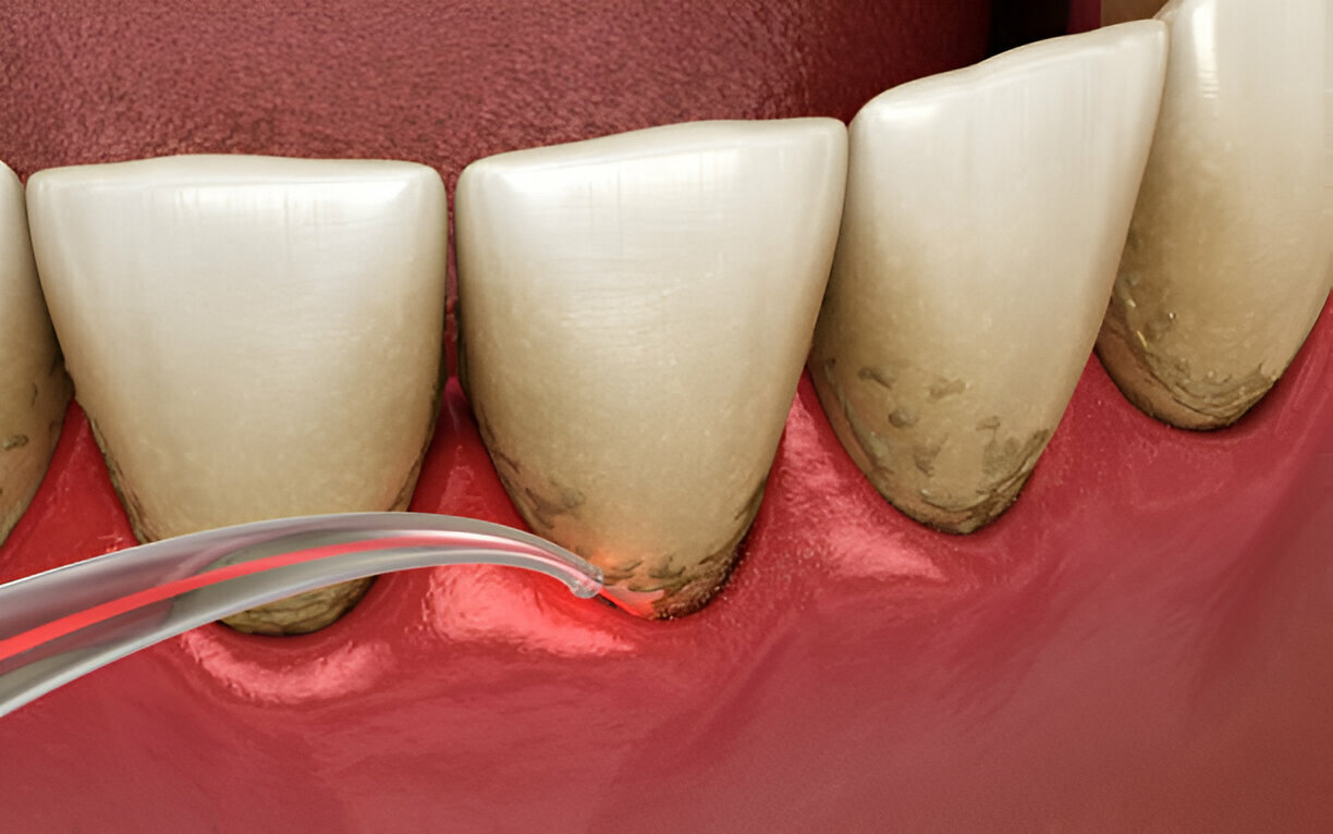 Top Benefits of Seeing a Restorative Dentist Regularly_1