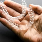 Invisalign at Sundance Dental: Top Benefits with a Trusted Dentist in Bloomfield_FI