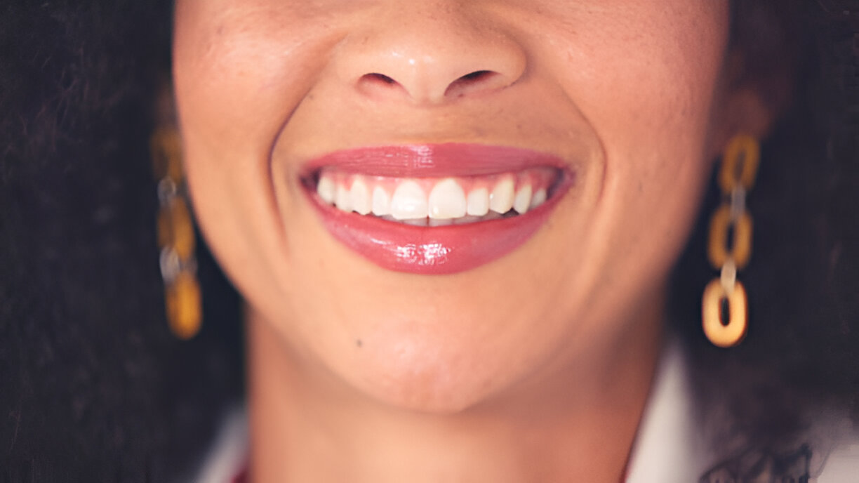 Teeth Whitening Dentists Near Me: Why Bloomfield Residents Trust Sundance Dental_1