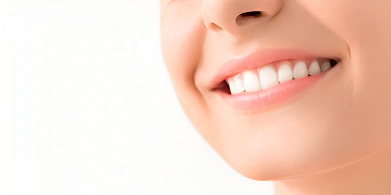 Teeth Whitening Dentists Near Me: Why Bloomfield Residents Trust Sundance Dental_FI