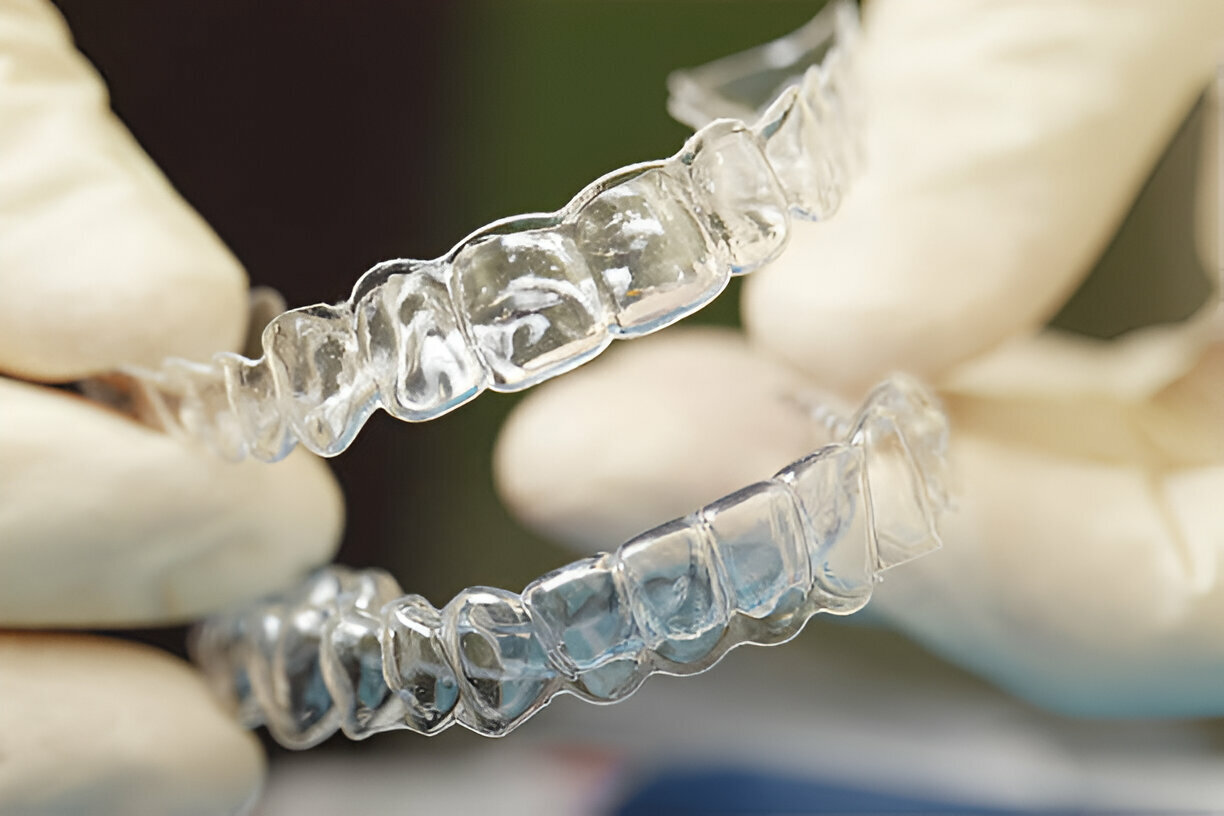 How Invisalign Can Improve Your Smile: A Comprehensive Guide from Sundance Dental in Grants_2