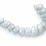 How Invisalign Can Improve Your Smile: A Comprehensive Guide from Sundance Dental in Grants_FI