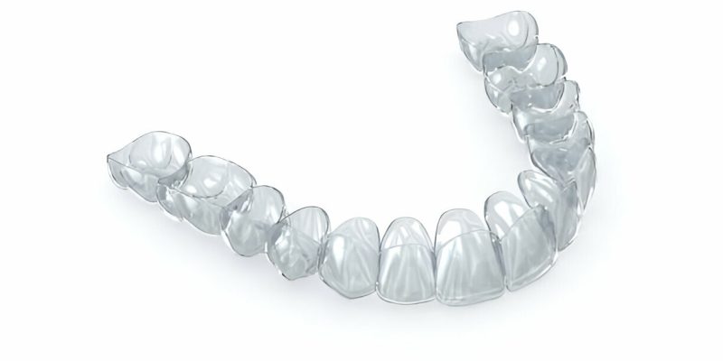 How Invisalign Can Improve Your Smile: A Comprehensive Guide from Sundance Dental in Grants_FI